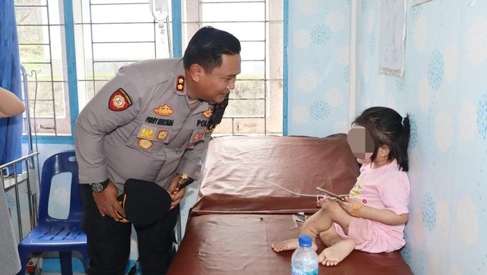 Viral Bocah 10 Tahun di Nias Selatan Diduga Disiksa Keluarganya hingga Alami Cacat Permanen